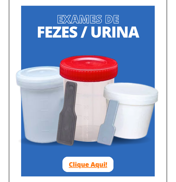 Exames de Fezes/Urina